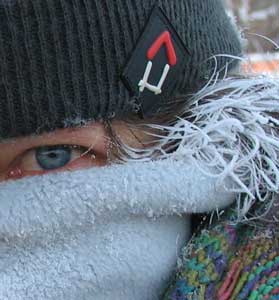 Frosty Hair